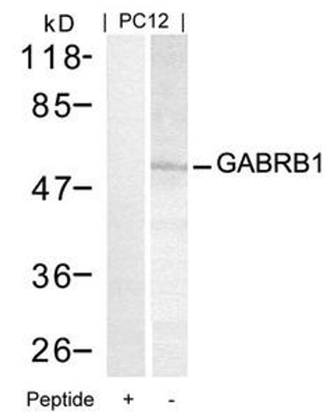 GABRB1 (Ab-434) Antibody (PACO21394)