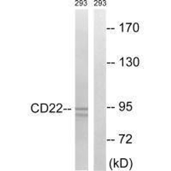 CD22 (Ab-807) Antibody (PACO21615)