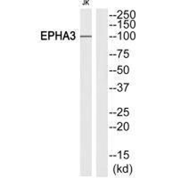 EPHA3 (Ab-602) Antibody (PACO21643)