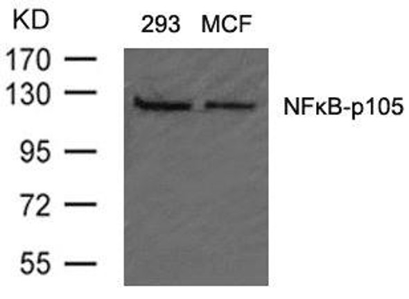 NFKB1 (Ab-907) Antibody (PACO22866)