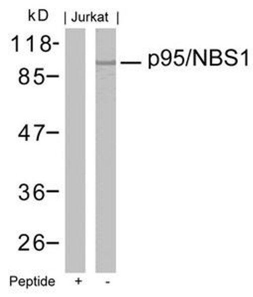 NBN (Ab-343) Antibody (PACO22891)