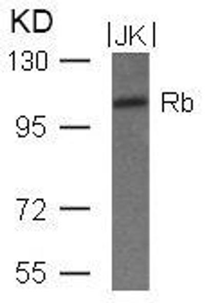 RB1 (Ab-780) Antibody (PACO22909)