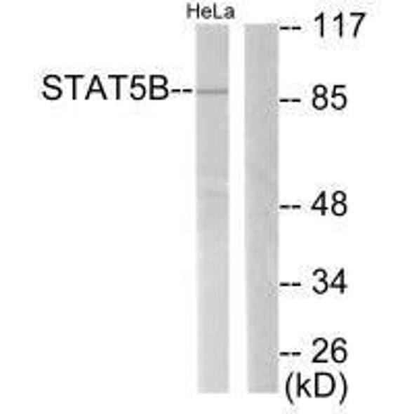 STAT5B (Ab-731) Antibody (PACO23025)