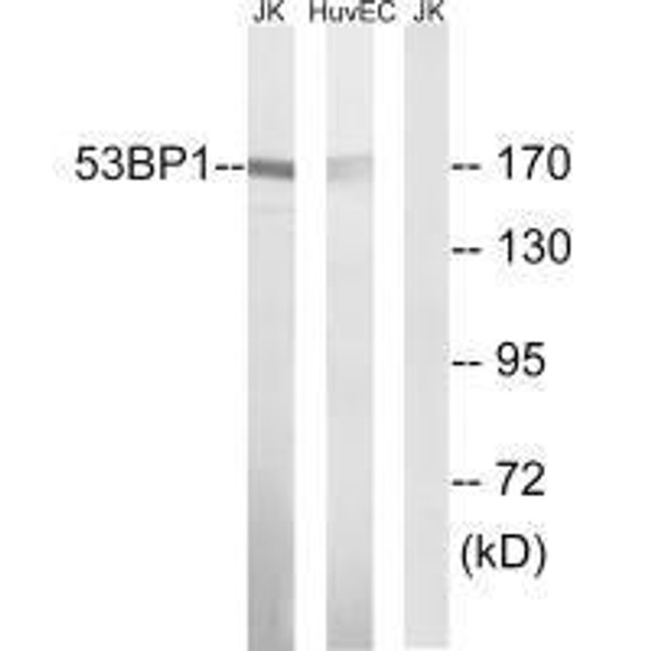 TP53BP1 (Ab-29) Antibody (PACO23074)