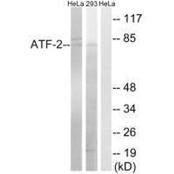 ATF2 (Ab-472) Antibody (PACO23077)