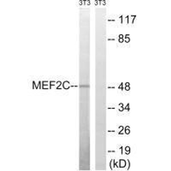 MEF2C (Ab-396) Antibody (PACO23081)