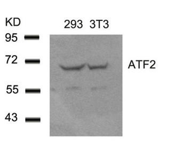 ATF2 (Ab-62 or 44) Antibody (PACO23539)