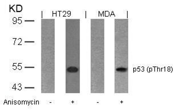 Phospho-TP53 (Thr18) Antibody (PACO23850)