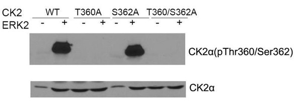 Phospho-CSNK2A1 (Thr360/Ser362) Antibody (PACO23909)