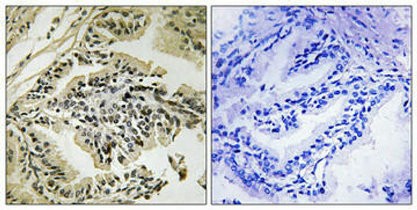 Phospho-EIF2AK3 (Thr981) Antibody (PACO24119)