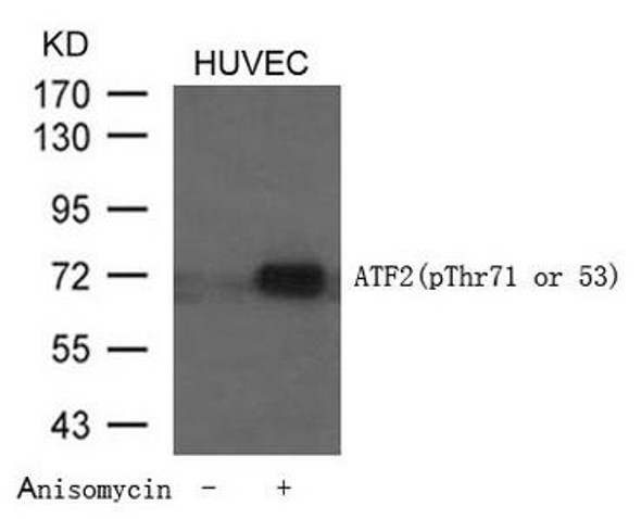 Phospho-ATF2 (Thr71 or 53) Antibody (PACO24231)