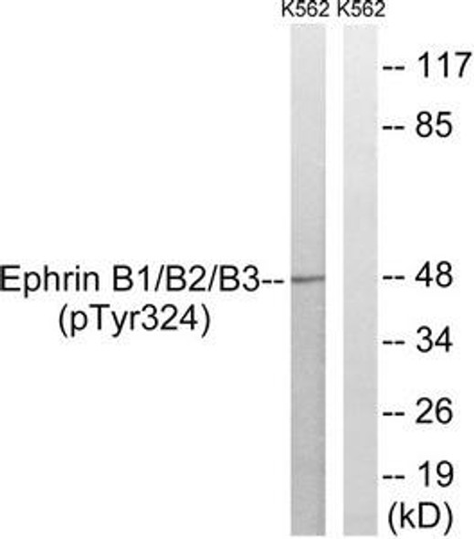 Phospho-EFNB1/EFNB2/EFNB3 (Tyr324) Antibody (PACO24401)