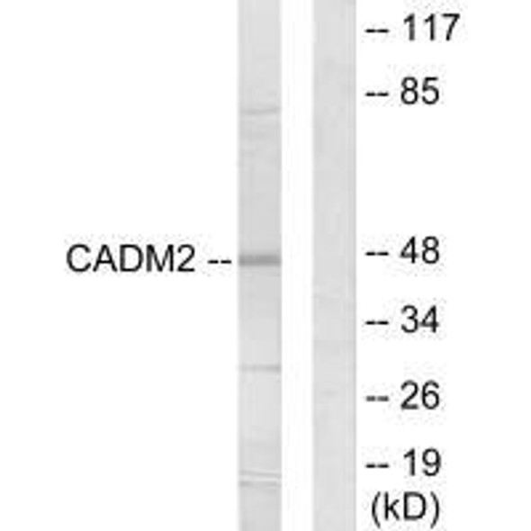 CADM2 Antibody (PACO22022)