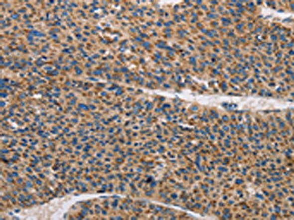 TLR8 Antibody (PACO13903)