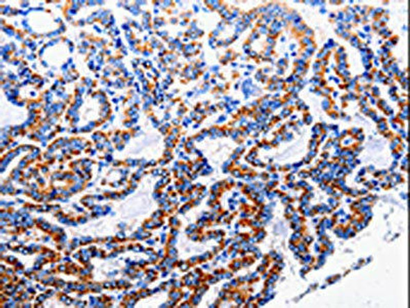 NFKB1 Antibody (PACO13928)