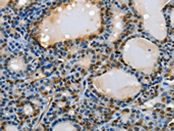 NFKBID Antibody (PACO13939)