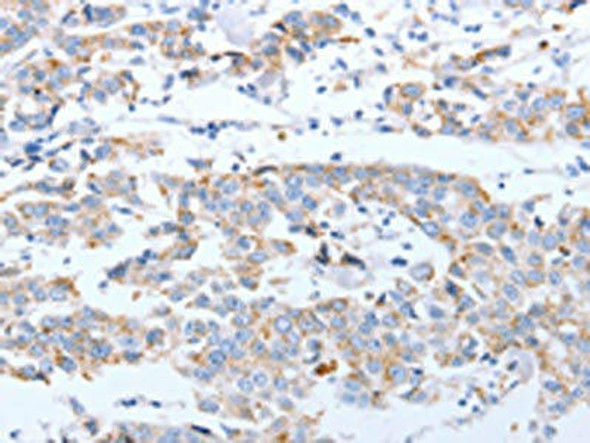 ARF4 Antibody (PACO14081)