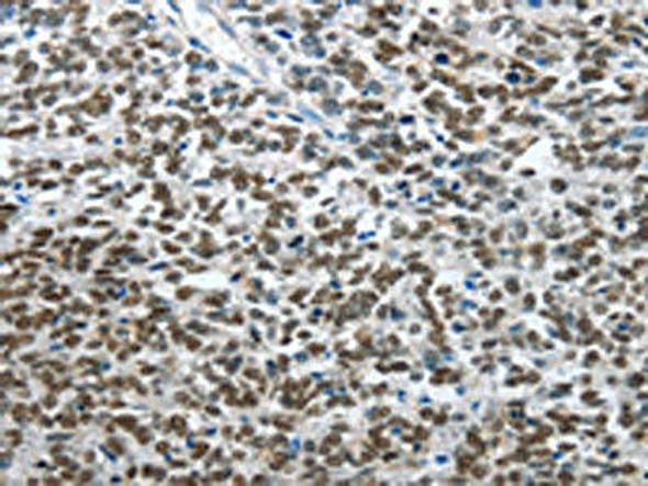 ARL2 Antibody (PACO14083)