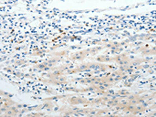 LCN2 Antibody (PACO18747)