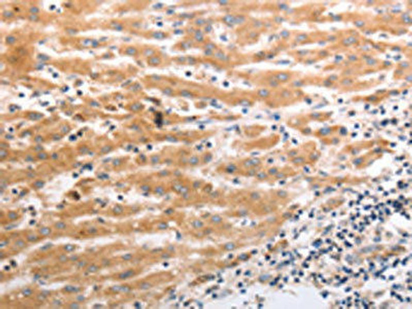 HCRTR1 Antibody (PACO18795)