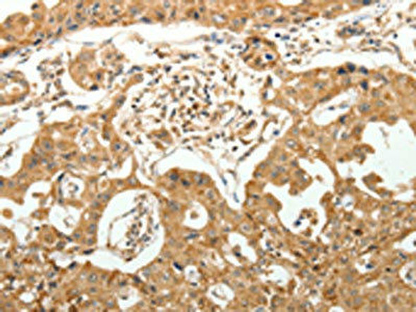 MAP1B Antibody (PACO18953)