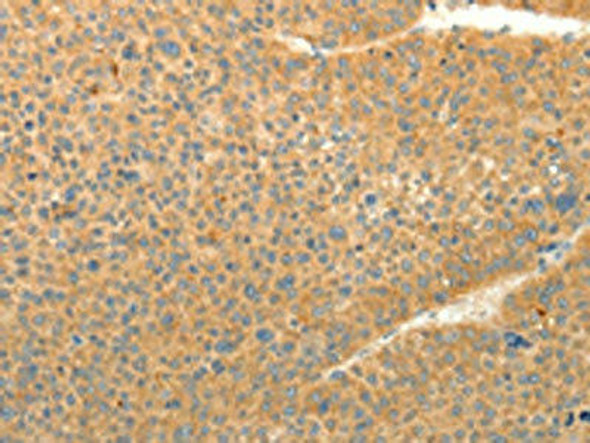 LPAR3 Antibody (PACO19015)