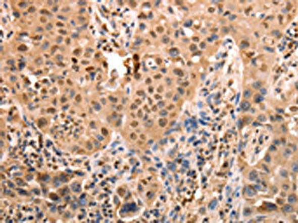 ACO2 Antibody (PACO19047)