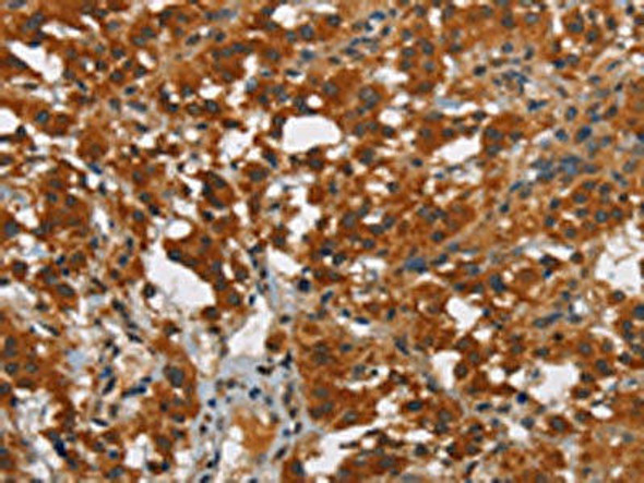 SMAD9 Antibody (PACO19299)