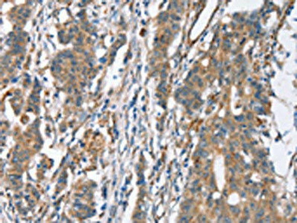 SLC4A1 Antibody (PACO19341)