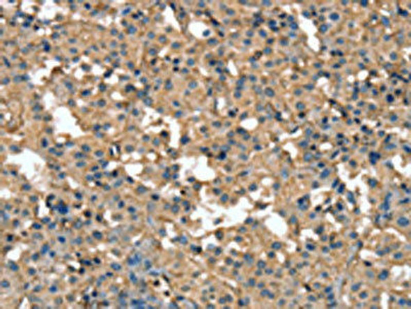 CR1 Antibody (PACO19505)