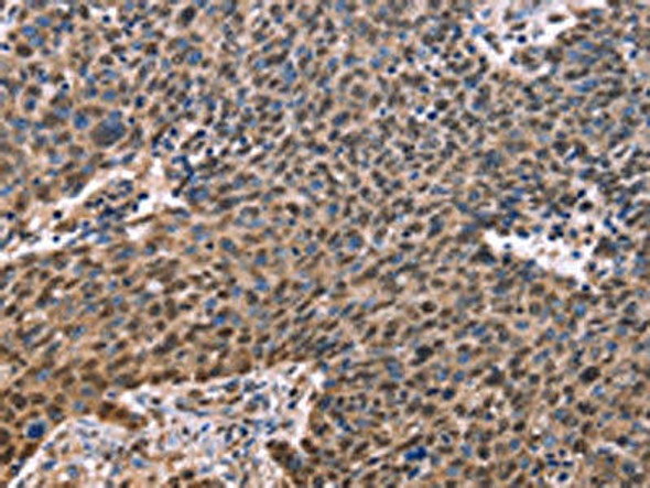 EVC2 Antibody (PACO19629)