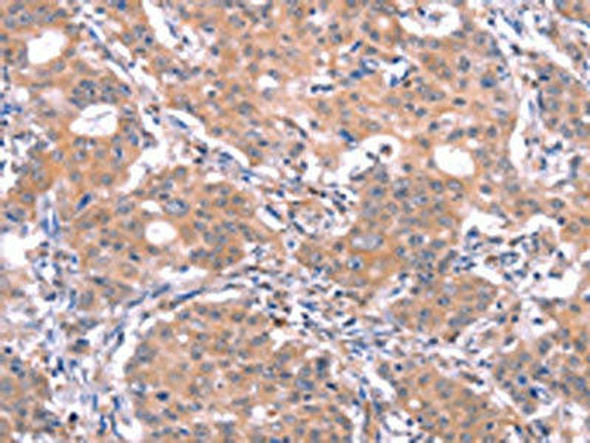 GABRA1 Antibody (PACO19687)