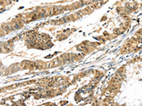 PSMB8 Antibody (PACO19949)