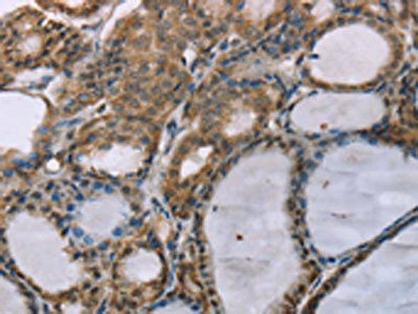 ACTN2 Antibody (PACO20391)