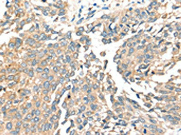 SIRT4 Antibody (PACO20470)