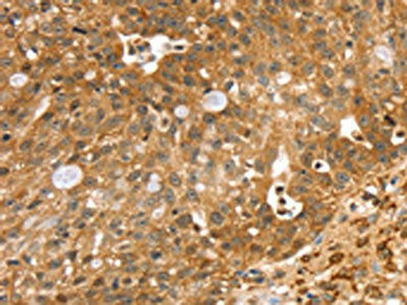 SORT1 Antibody (PACO20585)