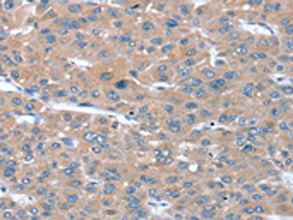 SULF1 Antibody (PACO20624)