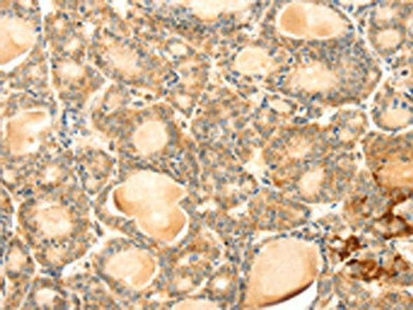 EVA1A Antibody (PACO20713)