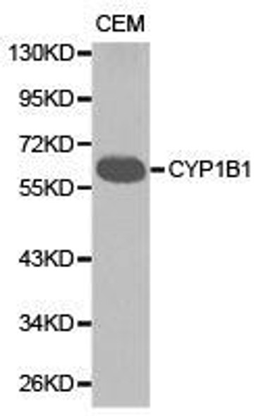 CYP1B1 Antibody (PACO21130)