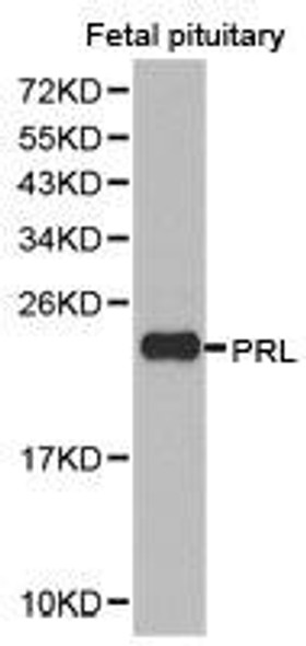 PRL Antibody (PACO21168)