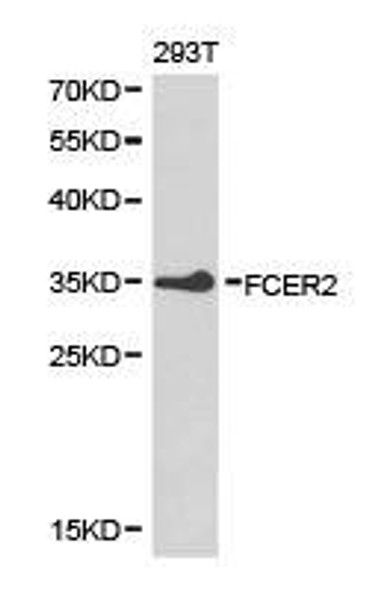 FCER2 Antibody (PACO21209)