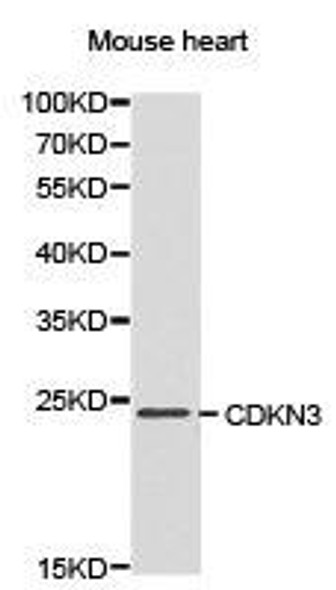 CDKN3 Antibody (PACO21233)