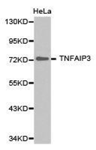 TNFAIP3 Antibody (PACO21258)