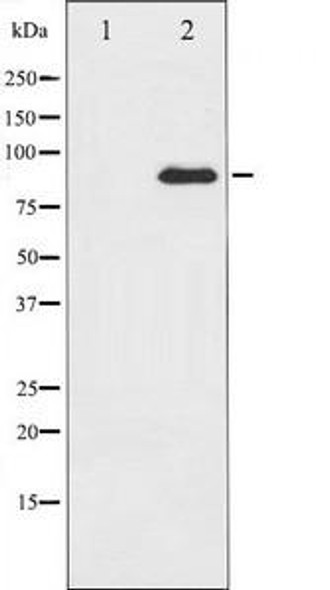 PRKCZ Antibody (PACO21309)