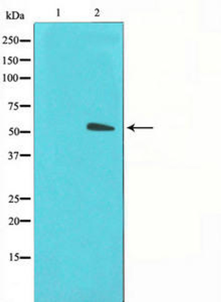 SLC2A3 Antibody (PACO21325)