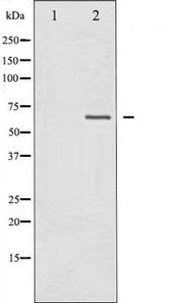 NF2 Antibody (PACO21330)