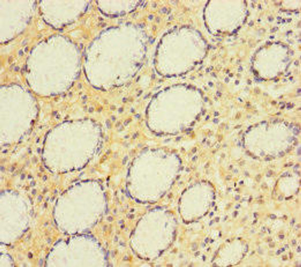 A4GNT Antibody (PACO24668)