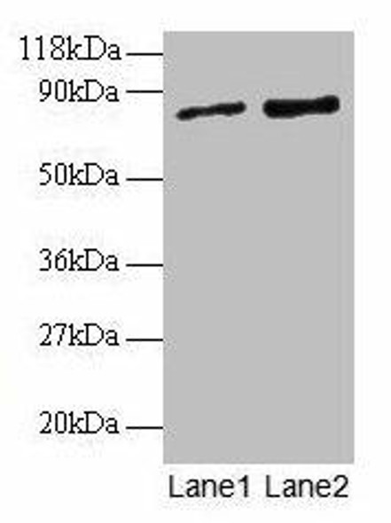 RAB1A Antibody (PACO25320)