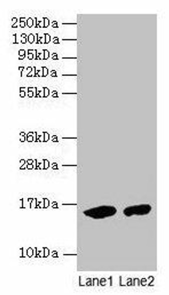 Hemoglobin Antibody (PACO25588)