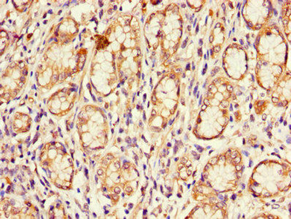 CDKN2B Antibody (PACO25692)